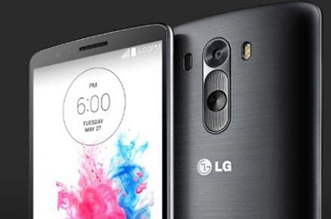 lgg31401010504
